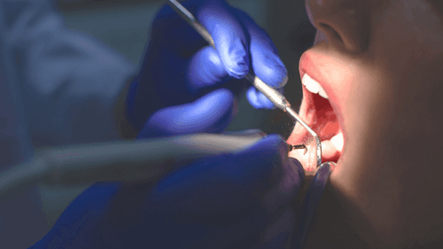 Imagem da noticia: From Pain to Well-being: The New Era of Dentistry with Cannabis