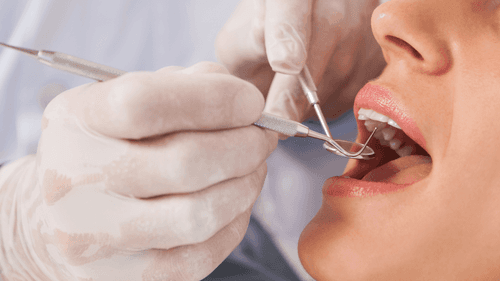 Imagem da noticia: After dental extractions, cannabidiol emerges as an option for pain