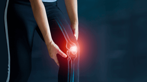 Imagem da noticia: Cannabis e dor crônica: estudo clínico busca alívio para quem convive com osteoartrite