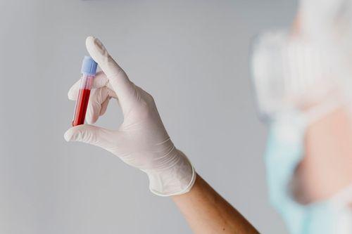 Cannabis não afeta a cognição em pessoas com HIV, diz estudo 