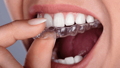 Como a cannabis está transformando os tratamentos odontológicos