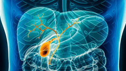 Uso de cannabis pode prolongar a vida em casos de câncer biliar