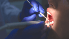 THC apresenta efeito antimicrobiano contra bactéria associada às cáries, aponta estudo científico