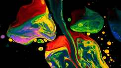 LSD em altas doses pode ajudar quem convive com a depressão