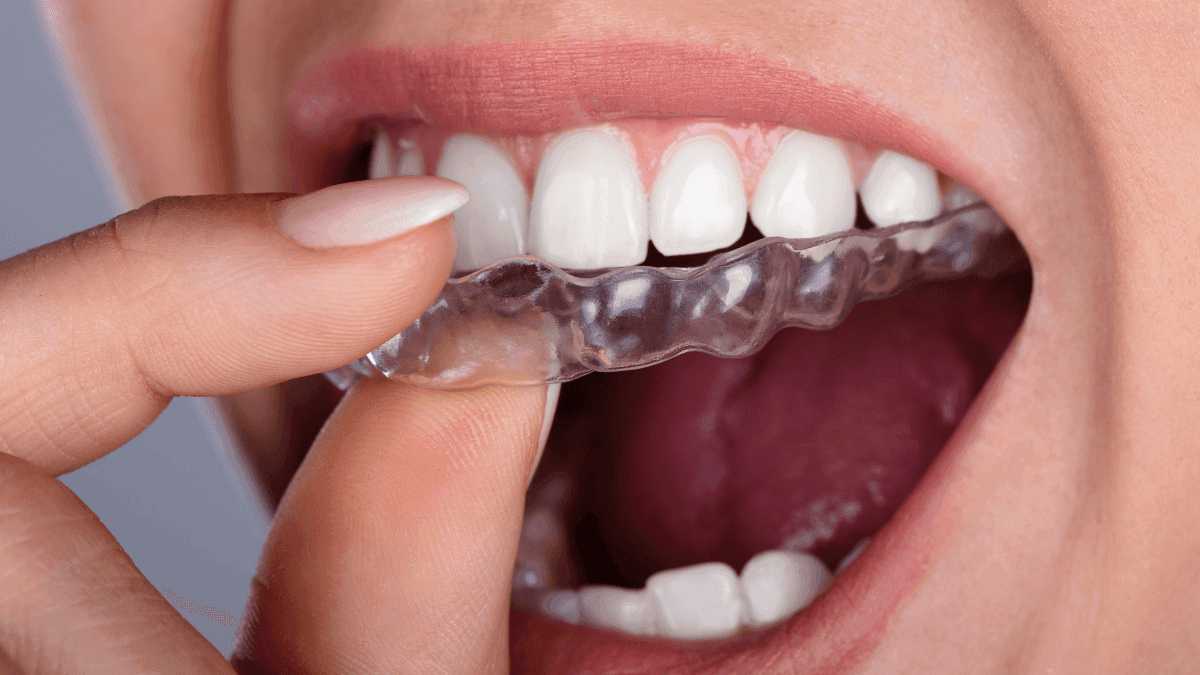 Como a cannabis está evoluindo os tratamentos odontológicos
