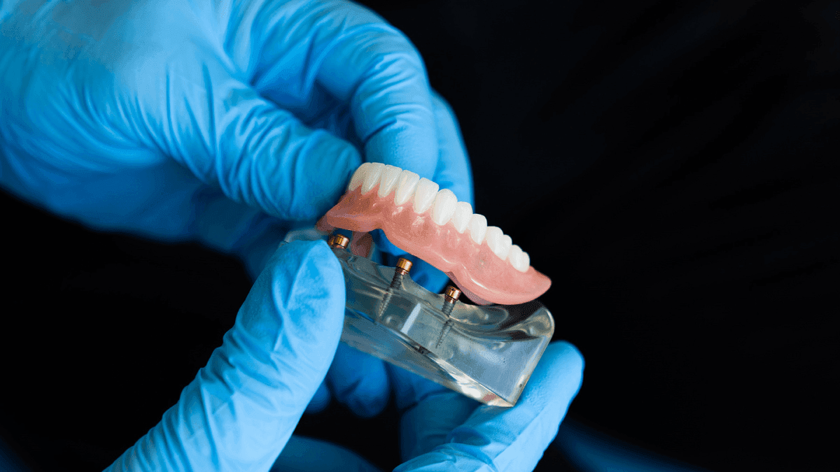 Revestimento de dentaduras com CBD pode prevenir infecções orais, indica estudo