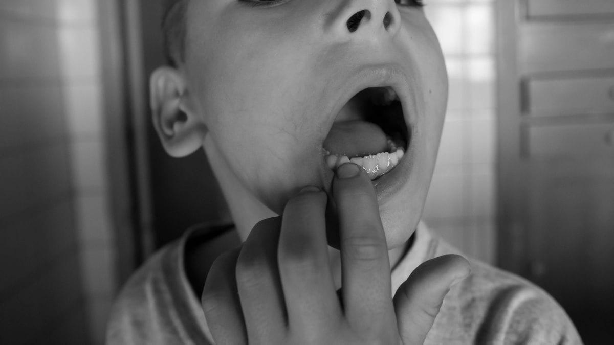 Prefeitura de São Joaquim de Bicas abre licitação para medicamento à base de cannabis