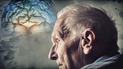 Imagem do editorial: Alzheimer