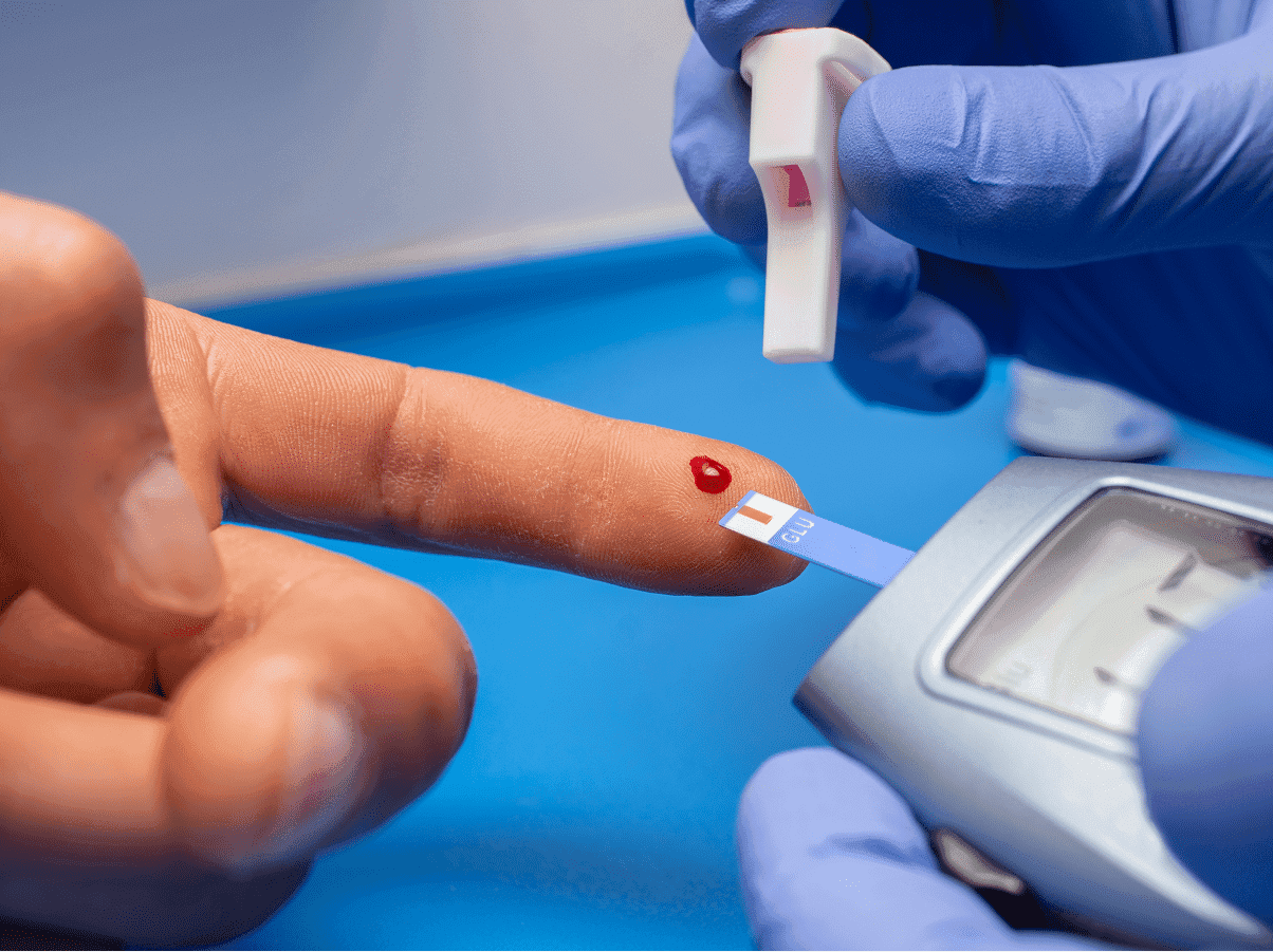 Cannabis aliada no tratamento de dores neuropáticas em pacientes com diabetes
