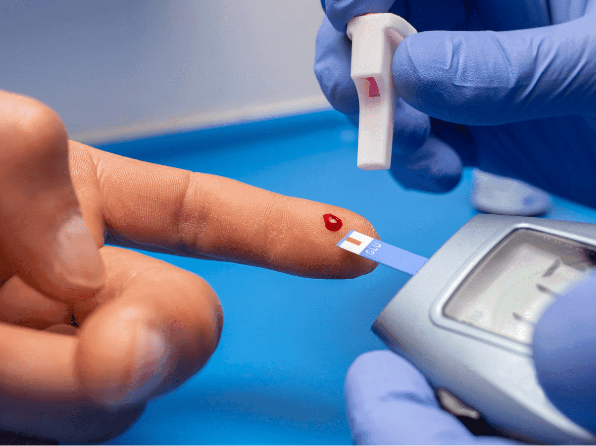 Cannabis aliada no tratamento de dores neuropáticas em pacientes com diabetes