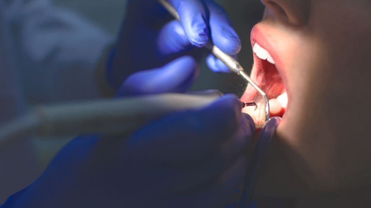 Estudo piloto aponta que CBD em alta concentração pode reduzir dor após extração dentária
