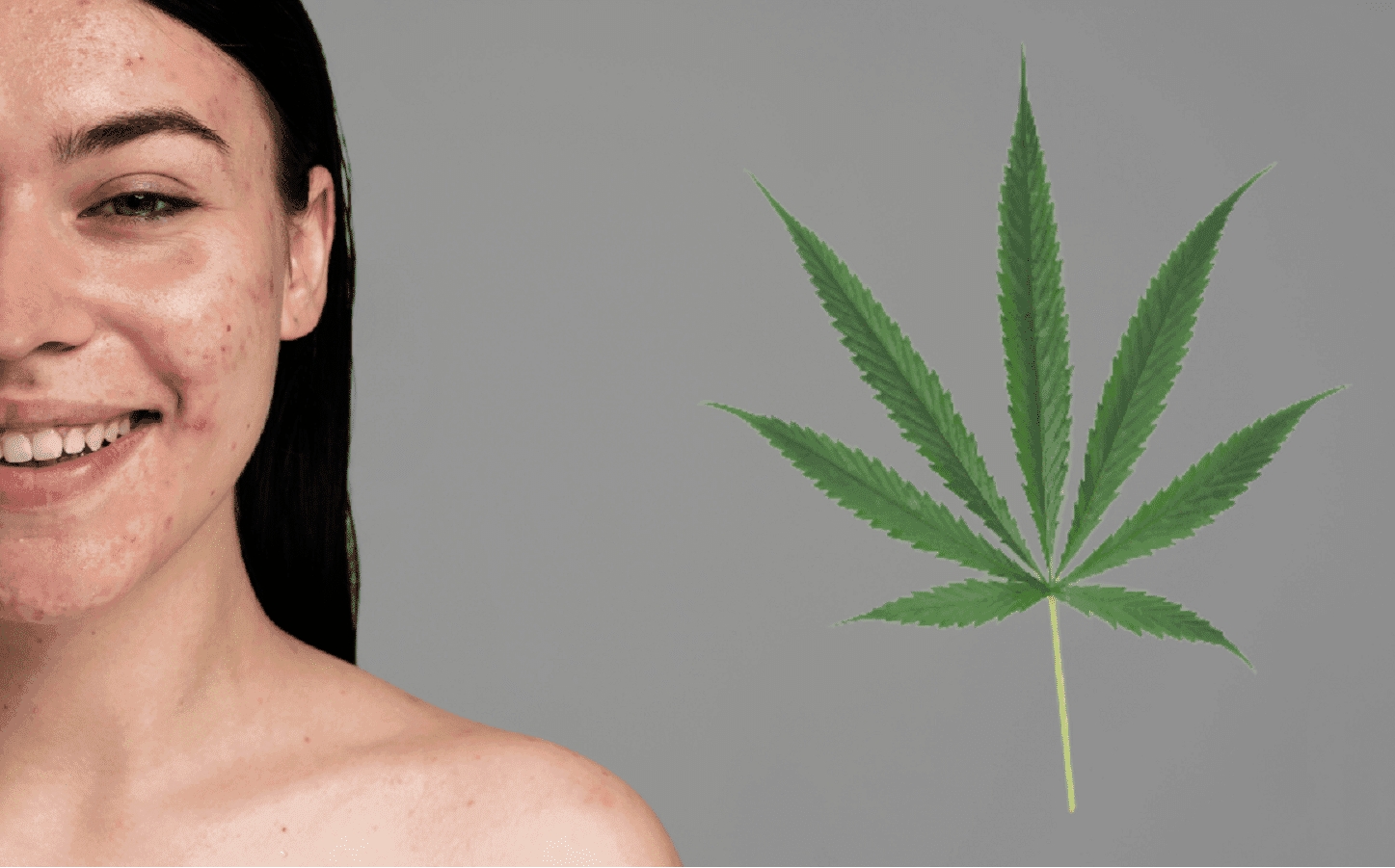 Estudo: canabinoides menos conhecidos podem ajudar a pele contra dermatite, psoríase e acne