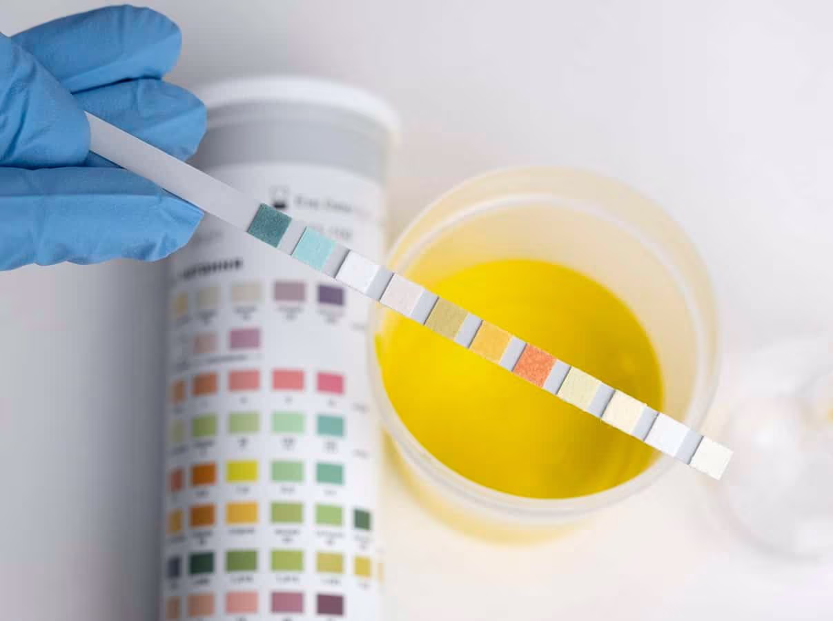 Saiba os tipos de exames toxicológicos de cannabis e como fazer a desintoxicação