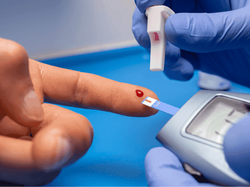 Cannabis aliada no tratamento de dores neuropáticas em pacientes com diabetes