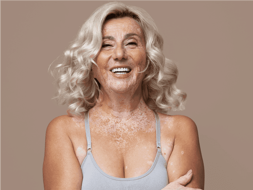 Cannabis como aliada no controle da menopausa