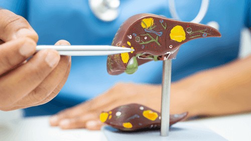 Study points to possible protective effect of cannabis on the liver in alcohol users