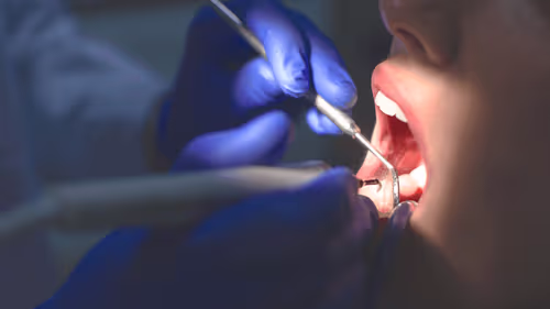 THC apresenta efeito antimicrobiano contra bactéria associada às cáries, aponta estudo científico