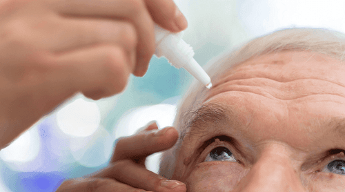 Colírio à base de cannabis para tratamento glaucoma no Brasil?