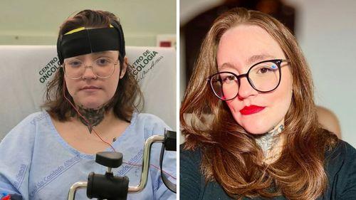 Imagem da noticia: Cannabis Self-Cultivation Offers Hope Against "Worst Pain in the World"