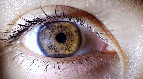 Glaucoma: cannabis pode ser eficaz contra a hipertensão ocular, diz estudo