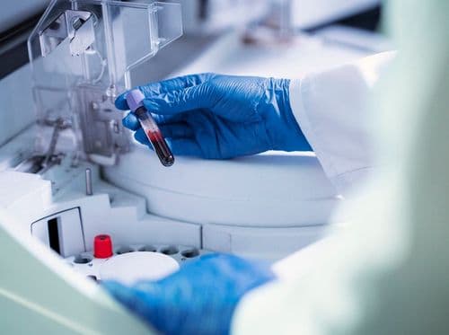 Interações entre o canabidiol e a ayahuasca