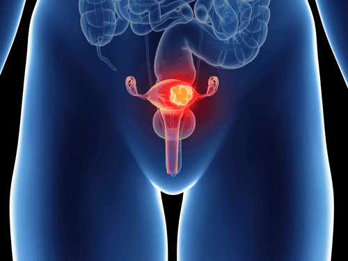 Start-up brasileira mira em solução para disfunção sexual